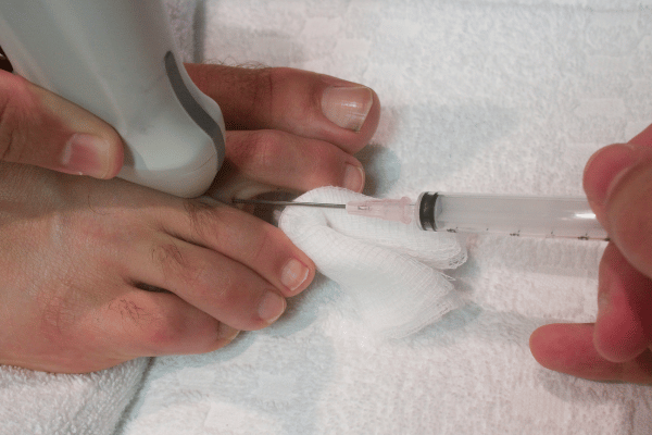 Morton's Neuroma Treatment Options